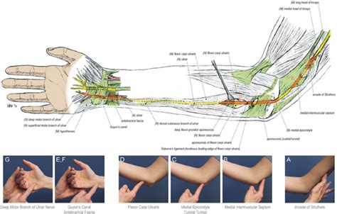 is there a test for ulnar nerve compression|ulnar nerve treatment without surgery.